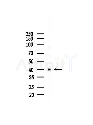 MSHR Antibody - Western blot analysis of lysates from LoVo cells(heat-shock,45min treatment), using MSHR Antibody at 1/1000 dilution.