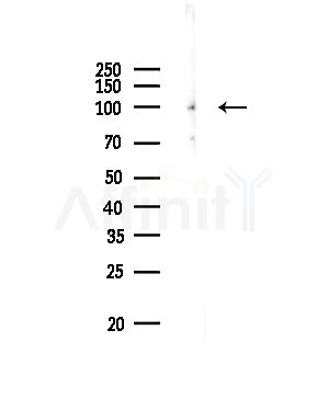 EPHA3 Antibody - Western blot analysis of lysates from Rat brain, using EPHA3 Antibody at 1/1000 dilution.