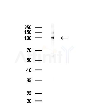 EPHA3 Antibody - Western blot analysis of lysates from HepG2 cells, using EPHA3 Antibody at 1/1000 dilution.