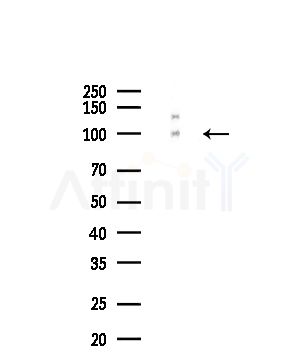 EPHA3 Antibody - Western blot analysis of lysates from COLO205 cells(UV,30min treatment), using EPHA3 Antibody at 1/1000 dilution.