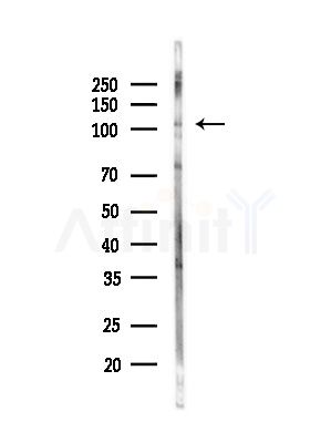 EPHA1 Antibody - Western blot analysis of lysates from HUVEC cells(starvation,24h treatment), using EPHA1 Antibody at 1/1000 dilution.