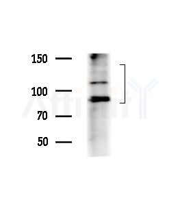 CD6 Antibody - Western blot analysis of extracts from Mouse testis, using CD6 Antibody at 1/1000 dilution.