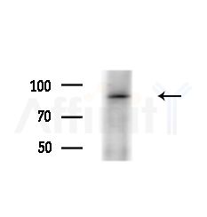 CD6 Antibody - Western blot analysis of extracts from Hela cells(starvation treatment), using CD6 Antibody at 1/1000 dilution.