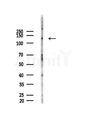 CD6 Antibody - Western blot analysis of lysates from B16F10-HUC(heat-shock treatment), using CD6 Antibody at 1/1000 dilution.
