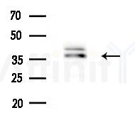 hnRNP C1/C2 Antibody - Western blot analysis of extracts from HepG2 cells(starvation treatment), using hnRNP C1/C2 Antibody at 1/1000 dilution.