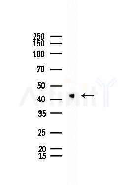hnRNP G Antibody - Western blot analysis of lysates from A375 cells(starvation,24h treatment), using hnRNP G Antibody at 1/1000 dilution.