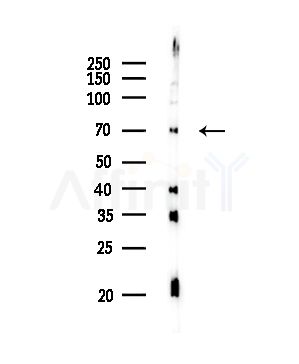 Keap1 Antibody - Western blot analysis of lysates from Rat brain, using Keap1 Antibody at 1/1000 dilution.