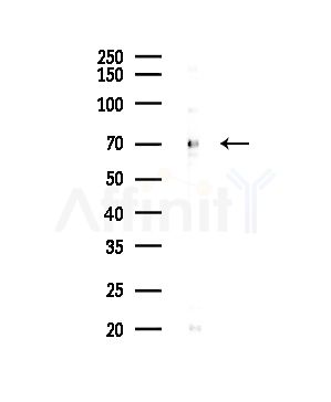 Keap1 Antibody - Western blot analysis of lysates from COLO205 cells(UV,30min treatment), using Keap1 Antibody at 1/1000 dilution.