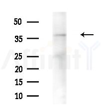 hnRNP A1 Antibody - Western blot analysis of extracts from B16F10-HUC(heat-shock treatment), using hnRNP A1 Antibody at 1/1000 dilution.