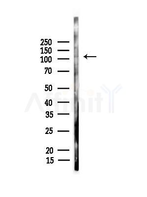 EPHB4 Antibody - Western blot analysis of lysates from Rat liver, using EPHB4 Antibody at 1/1000 dilution.