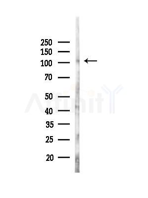 EPHB4 Antibody - Western blot analysis of lysates from EC304 cells(heat-shock,45min treatment), using EPHB4 Antibody at 1/1000 dilution.