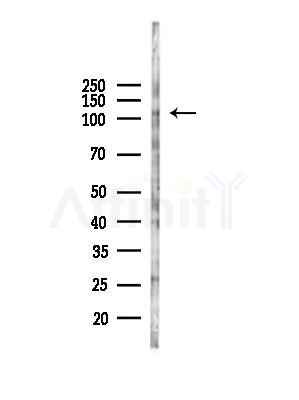 EPHB4 Antibody - Western blot analysis of lysates from HepG2 cells(starvation,24h treatment), using EPHB4 Antibody at 1/1000 dilution.
