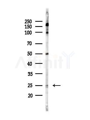 CD69 Antibody - Western blot analysis of lysates from PC12 cells(heat-shock,45min treatment), using CD69 Antibody at 1/1000 dilution.