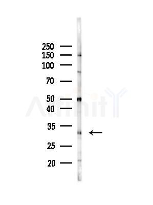 CD69 Antibody - Western blot analysis of lysates from MCF7 cells(heat-shock,45min treatment), using CD69 Antibody at 1/1000 dilution.
