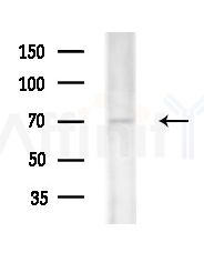 hnRNP M Antibody - Western blot analysis of extracts from Mouse testis, using hnRNP M Antibody at 1/1000 dilution.