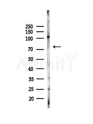 hnRNP M Antibody - Western blot analysis of lysates from Mouse testis, using hnRNP M Antibody at 1/1000 dilution.