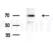 MEN1 Antibody - Western blot analysis of extracts from HepG2 cells(heat-shock treatment), using MEN1 Antibody at 1/1000 dilution.