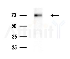 MEN1 Antibody - Western blot analysis of extracts from Hela cells(heat-shock treatment), using MEN1 Antibody at 1/1000 dilution.