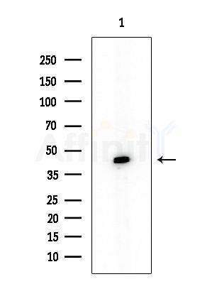 Galectin-9 Antibody - Western blot analysis of extracts from COLO205 cells, using Galectin-9 Antibody at 1/1000 dilution.