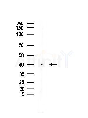 Galectin-9 Antibody - Western blot analysis of lysates from COLO205 cells, using Galectin-9 Antibody at 1/1000 dilution.