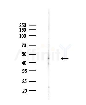 CMKLR1 Antibody - Western blot analysis of lysates from Hela cells(starvation,24h treatment), using CMKLR1 Antibody at 1/1000 dilution.