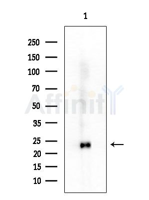 MGMT Antibody - Western blot analysis of extracts from HepG2 cells, using MGMT Antibody at 1/1000 dilution.