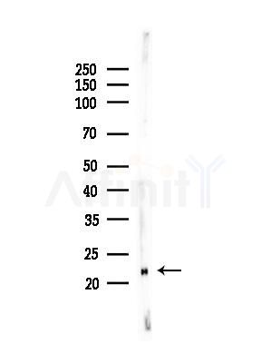 MGMT Antibody - Western blot analysis of lysates from HepG2 cells, using MGMT Antibody at 1/1000 dilution.
