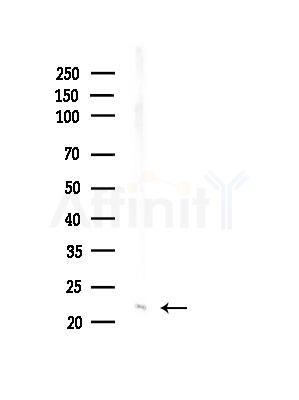 MGMT Antibody - Western blot analysis of lysates from EC304 cells, using MGMT Antibody at 1/1000 dilution.