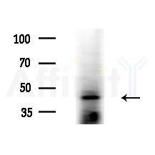 NRF1 Antibody - Western blot analysis of extracts from A375 cells(starvation,24h treatment), using NRF1 Antibody at 1/1000 dilution.