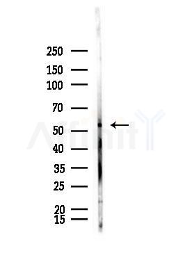 NRF1 Antibody - Western blot analysis of lysates from A375 cells(starvation,24h treatment), using NRF1 Antibody at 1/1000 dilution.