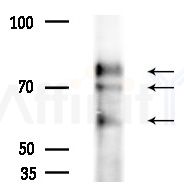 TRP2/DCT Antibody - Western blot analysis of extracts from A375 cells(heat-shock treatment), using TRP2/DCT Antibody at 1/1000 dilution.