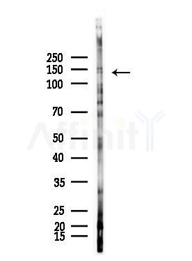 PERK Antibody - Western blot analysis of lysates from Raji cells(heat-shock,45min treatment), using PERK Antibody at 1/1000 dilution.