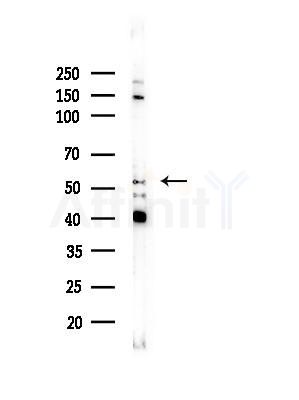 Cytochrome P450 1A1/2 Antibody - Western blot analysis of lysates from COS-7 cells(heat-shock, 45min treatment), using Cytochrome P450 1A1/2 Antibody at 1/1000 dilution.