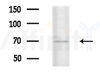 MTA1 Antibody - Western blot analysis of extracts from Mouse liver, using MTA1 Antibody at 1/1000 dilution.