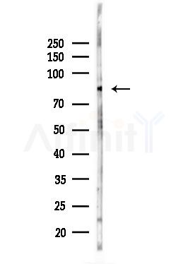Integrin beta 5 Antibody - Western blot analysis of lysates from HUVEC cells(UV,30min treatment), using Integrin beta 5 Antibody at 1/1000 dilution.