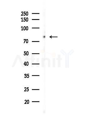 Integrin beta 5 Antibody - Western blot analysis of lysates from Hela cells(starvation,24h treatment), using Integrin beta 5 Antibody at 1/1000 dilution.