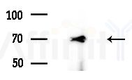 MMP2 Antibody - Western blot analysis of extracts from Rat liver, using MMP2 Antibody at 1/1000 dilution.