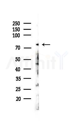 MMP2 Antibody - Western blot analysis of lysates from Rat liver, using MMP2 Antibody at 1/1000 dilution.