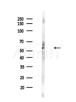 Desmin Antibody - Western blot analysis of lysates from PC12 cells(heat-shock,45min treatment), using Desmin Antibody at 1/1000 dilution.