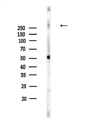 Fibronectin Antibody - Western blot analysis of lysates from Rat brain, using Fibronectin Antibody at 1/1000 dilution.