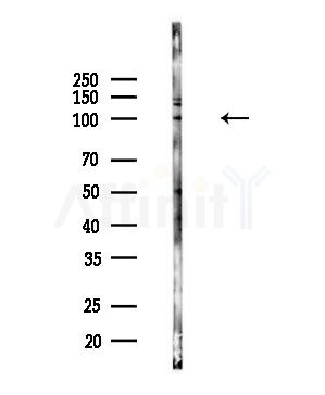 HSP105 Antibody - Western blot analysis of lysates from PC12 cells(LPS,4h treatment), using HSP105 Antibody at 1/1000 dilution.