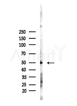 Transferrin Receptor Antibody - Western blot analysis of lysates from PC12 cells(heat-shock,45min treatment), using Transferrin Receptor Antibody at 1/1000 dilution.