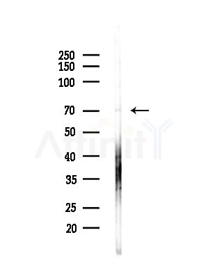 FAP Antibody - Western blot analysis of lysates from HepG2 cells(LPS,4h treatment), using FAP1 Antibody at 1/1000 dilution.