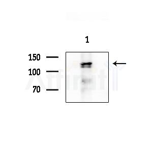 HDAC5 Antibody - Western blot analysis of extracts from Mouse testis, using HDAC5 Antibody at 1/1000 dilution.