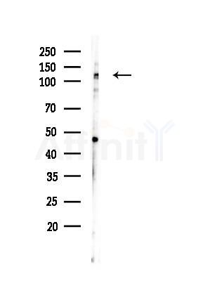 HDAC5 Antibody - Western blot analysis of lysates from Mouse testis, using HDAC5 Antibody at 1/1000 dilution.