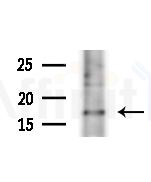 Gastrin Antibody - Western blot analysis of extracts from A375 cells(heat-shock,45min treatment), using Gastrin Antibody at 1/1000 dilution.