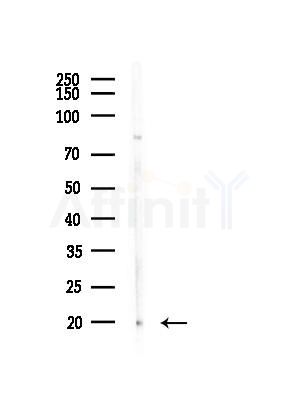 p18 INK4c Antibody - Western blot analysis of lysates from Mouse testis, using p18 INK4c Antibody at 1/1000 dilution.