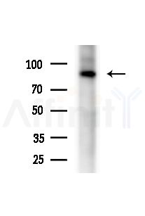Cyclin F Antibody - Western blot analysis of extracts from Rat brain, using Cyclin F Antibody at 1/1000 dilution.