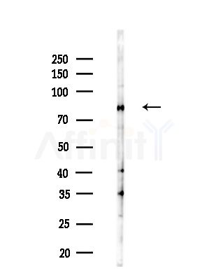 Calnexin Antibody - Western blot analysis of lysates from B16F10-LUC cells(LPS,4h treatment), using Calnexin Antibody at 1/1000 dilution.