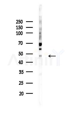 Cleaved-Caspase 4 (Gln81) Antibody - Western blot analysis of lysates from MCF7 cells(heat-shock,45min treatment), using Cleaved-Caspase 4 (Gln81) Antibody at 1/1000 dilution.